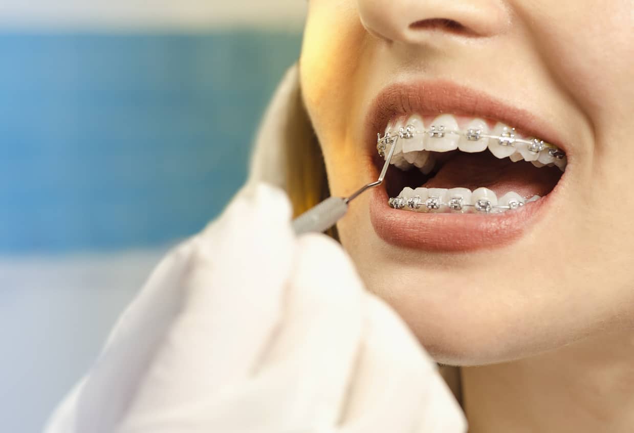 Mondhygiënist Mondhygiënist